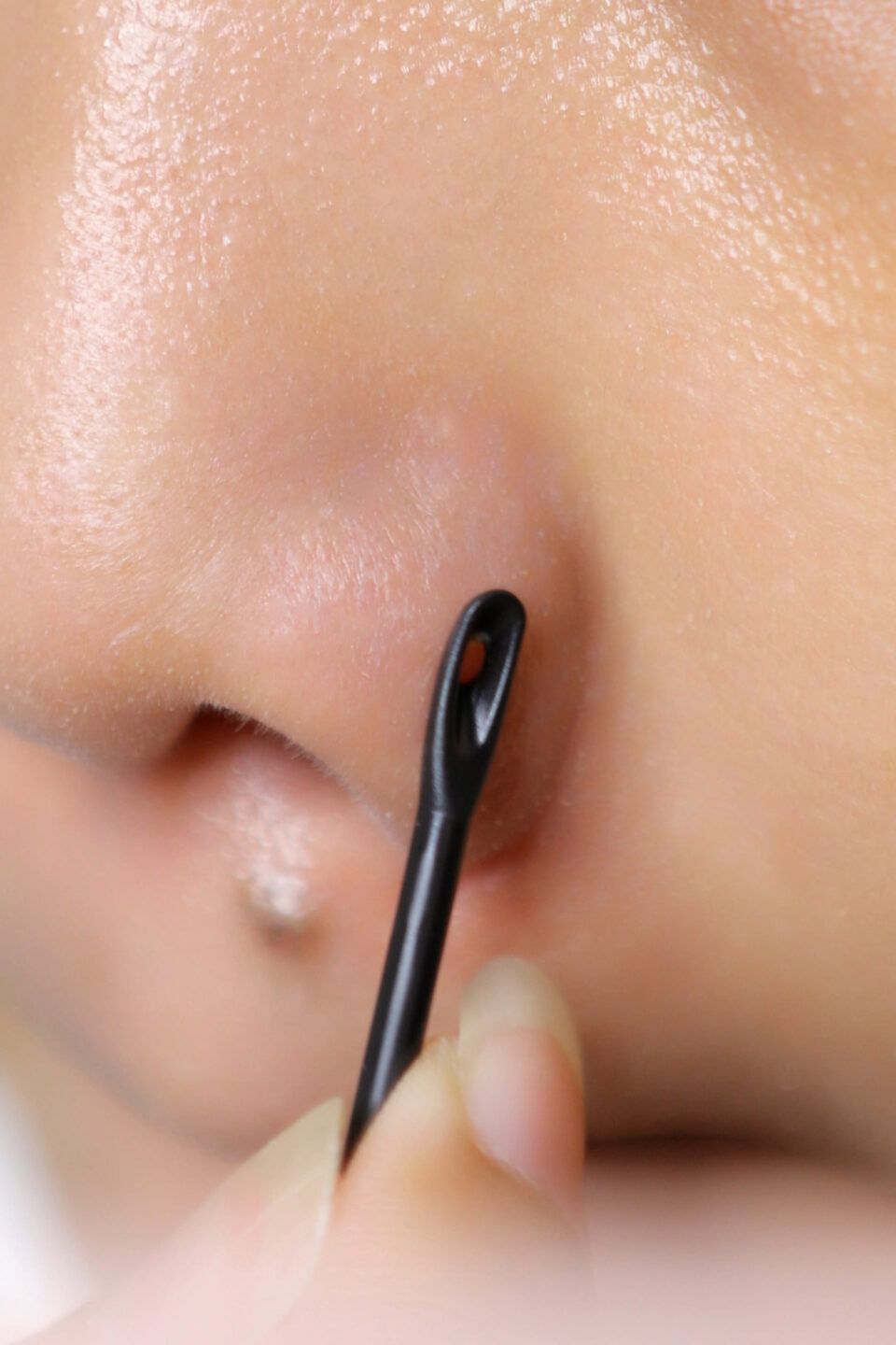 Dung Dịch Làm Mềm Mụn Đầu Đen Jumiso Hiệu Quả 10